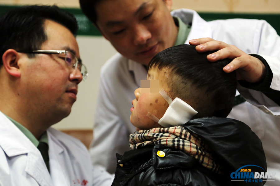 6歲男童慘遭嬸嬸割耳續(xù)：有醫(yī)院免費為他造左耳